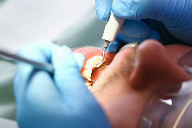 Best Pediatric Emergency Dentist in East Palatka, FL